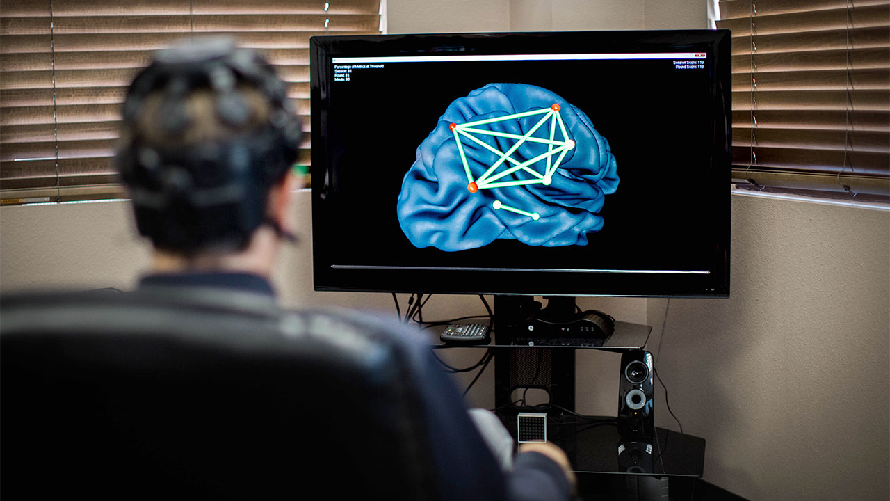 Neurofeedback Nedir?